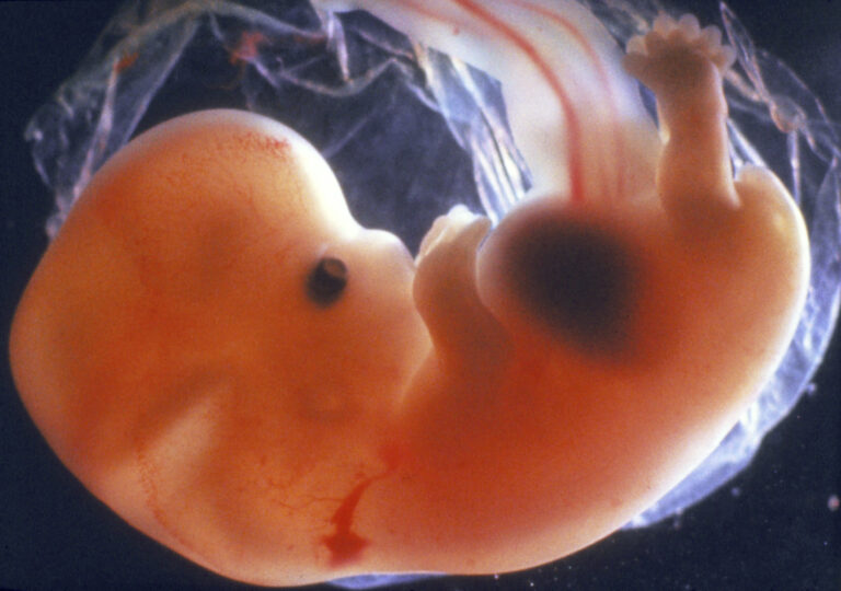 Human Embryos Have Gills: A Myth?